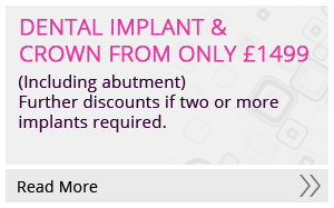 Dental Implant & Crown From Only £1349 